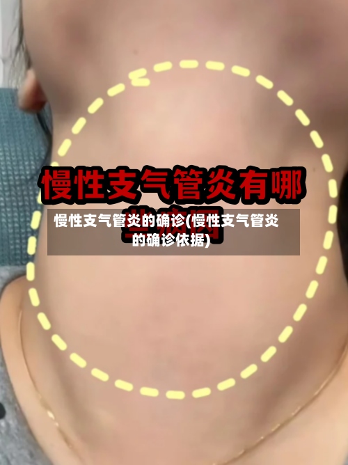 慢性支气管炎的确诊(慢性支气管炎的确诊依据)-第2张图片