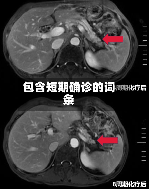 包含短期确诊的词条
