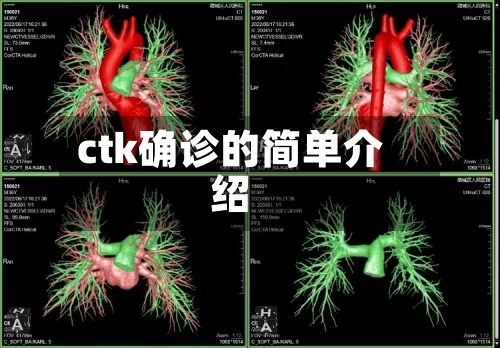 ctk确诊的简单介绍