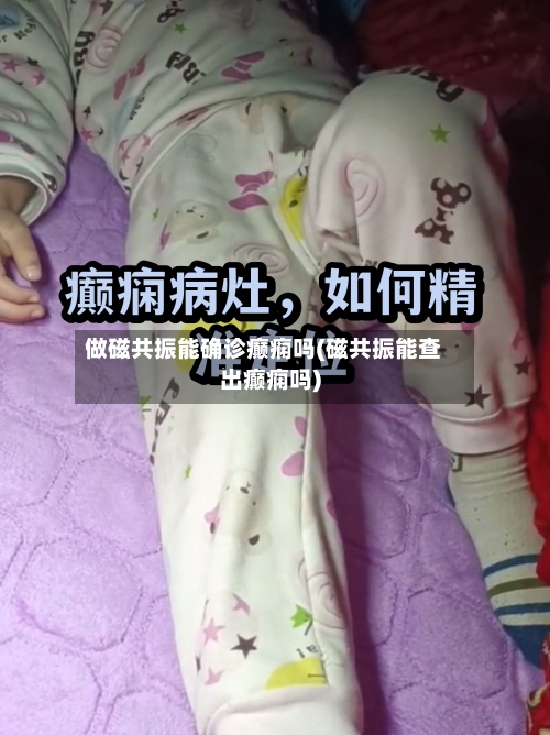 做磁共振能确诊癫痫吗(磁共振能查出癫痫吗)-第3张图片