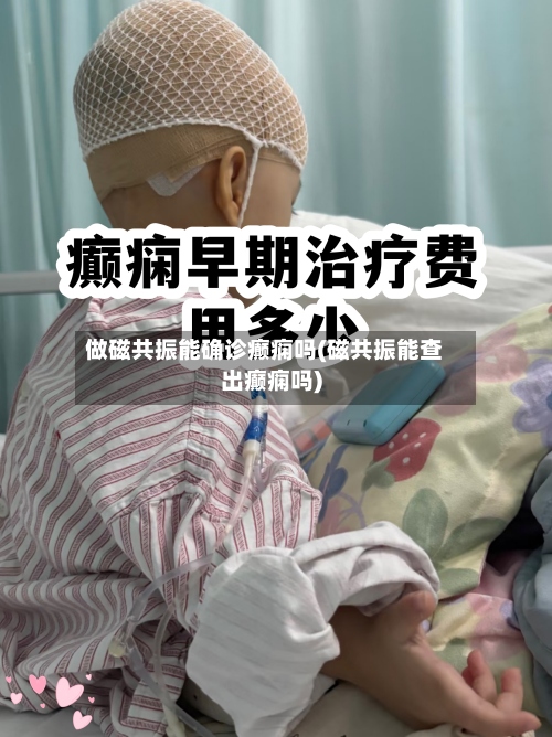 做磁共振能确诊癫痫吗(磁共振能查出癫痫吗)