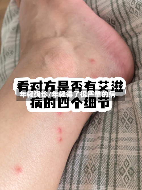 年轻确诊/年轻得了很严重的病