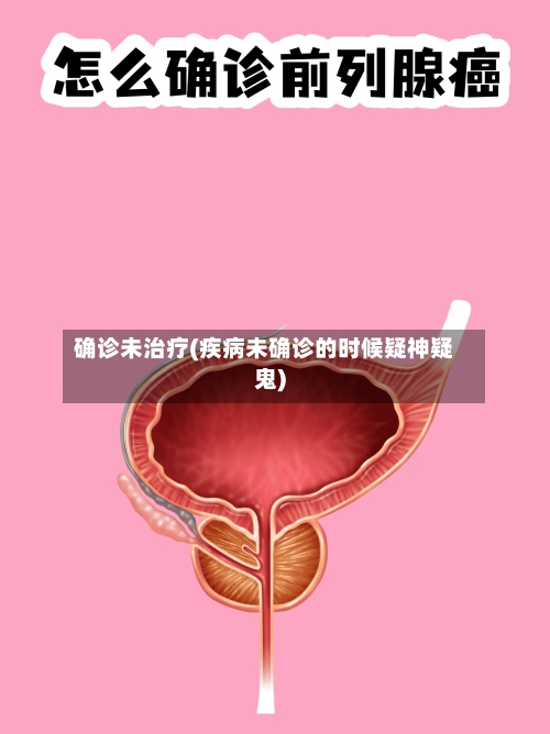 确诊未治疗(疾病未确诊的时候疑神疑鬼)