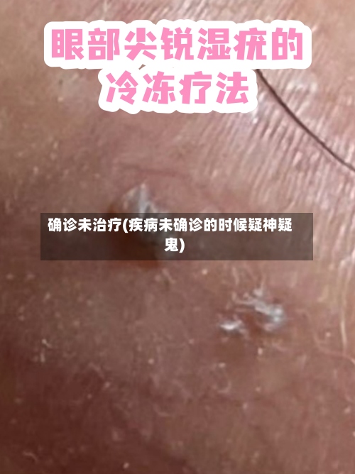 确诊未治疗(疾病未确诊的时候疑神疑鬼)-第3张图片