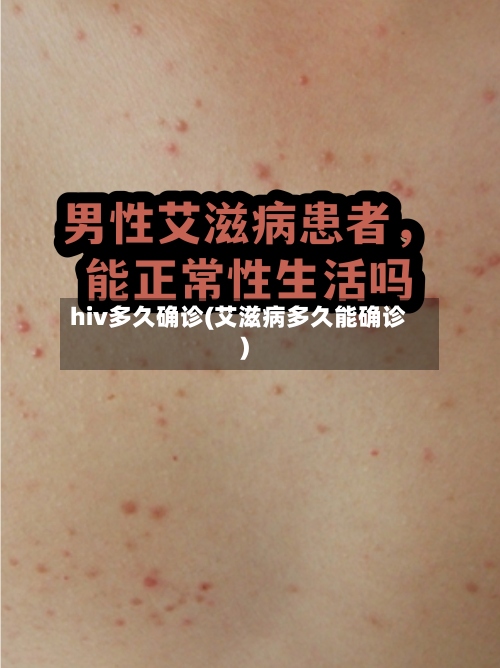 hiv多久确诊(艾滋病多久能确诊)-第2张图片