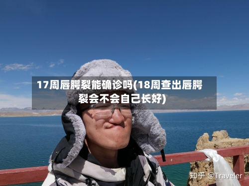 17周唇腭裂能确诊吗(18周查出唇腭裂会不会自己长好)