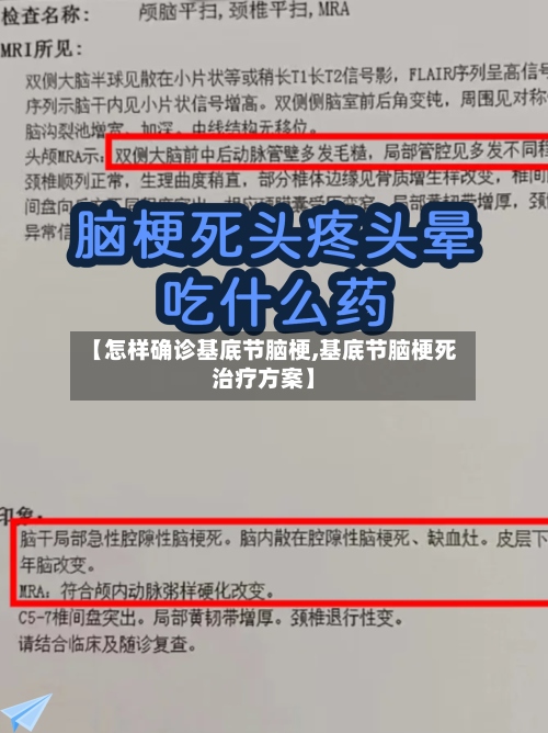 【怎样确诊基底节脑梗,基底节脑梗死治疗方案】-第3张图片