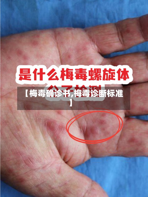 【梅毒确诊书,梅毒诊断标准】-第2张图片