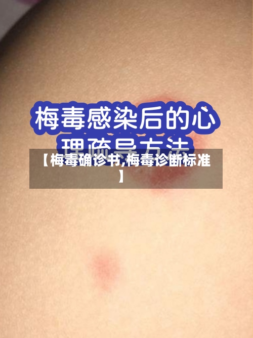 【梅毒确诊书,梅毒诊断标准】