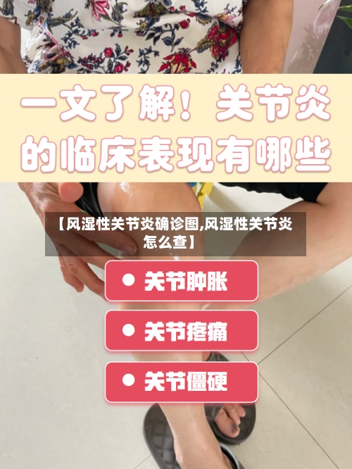 【风湿性关节炎确诊图,风湿性关节炎怎么查】-第3张图片
