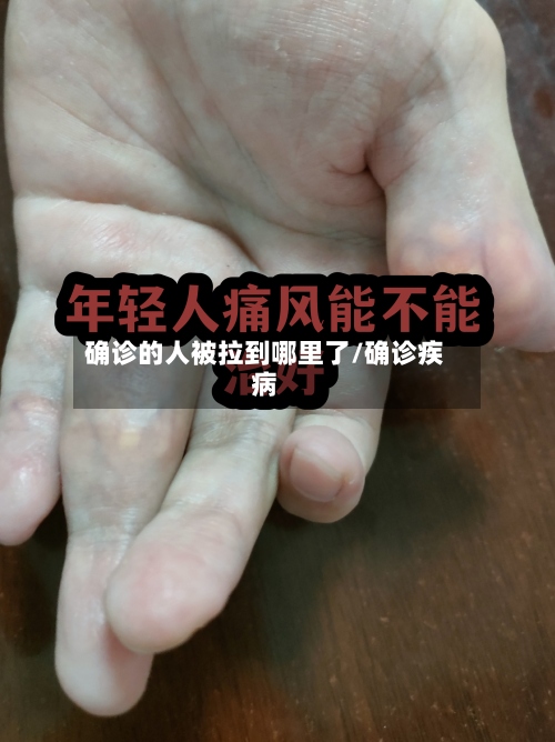 确诊的人被拉到哪里了/确诊疾病-第2张图片