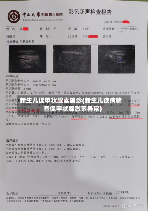 新生儿促甲状腺素确诊(新生儿疾病筛查促甲状腺激素异常)-第3张图片