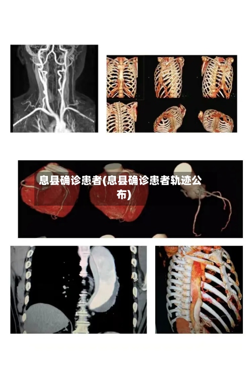 息县确诊患者(息县确诊患者轨迹公布)-第2张图片