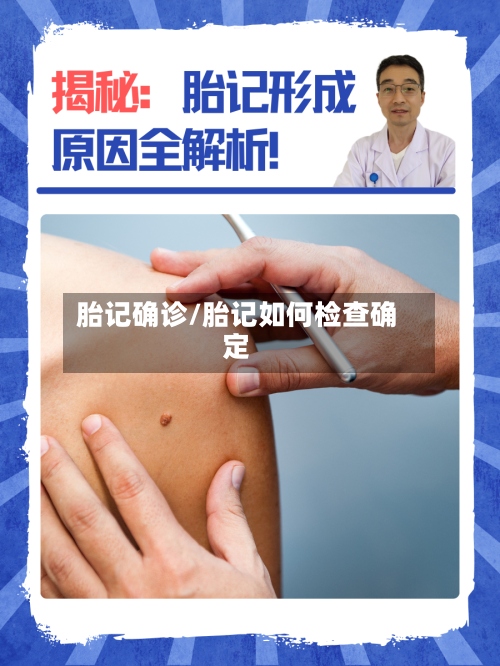胎记确诊/胎记如何检查确定