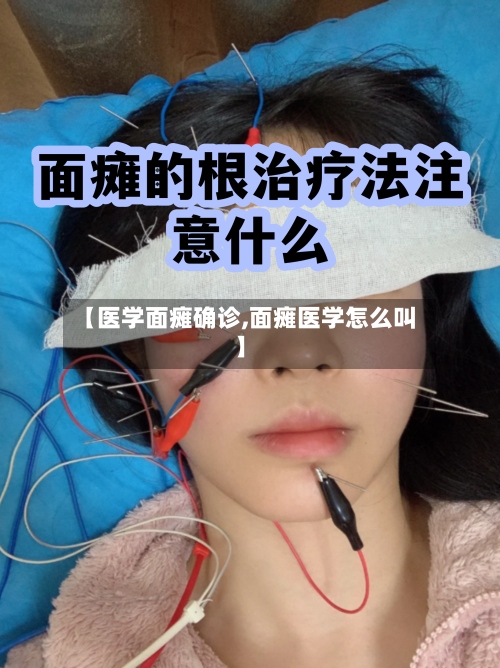 【医学面瘫确诊,面瘫医学怎么叫】