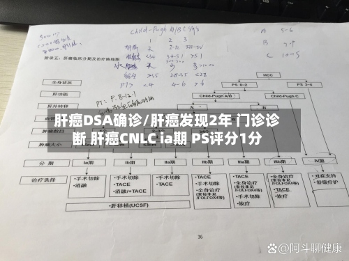 肝癌DSA确诊/肝癌发现2年 门诊诊断 肝癌CNLC ia期 PS评分1分
