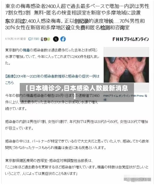 【日本确诊少,日本感染人数最新消息】