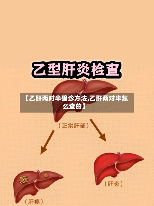 【乙肝两对半确诊方法,乙肝两对半怎么查的】-第2张图片