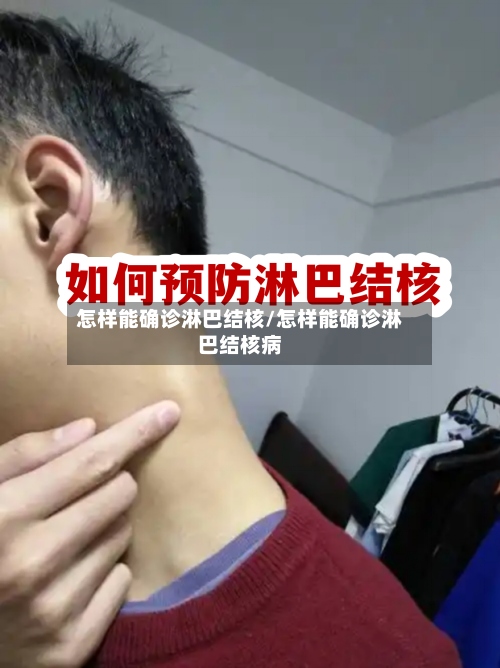 怎样能确诊淋巴结核/怎样能确诊淋巴结核病-第2张图片