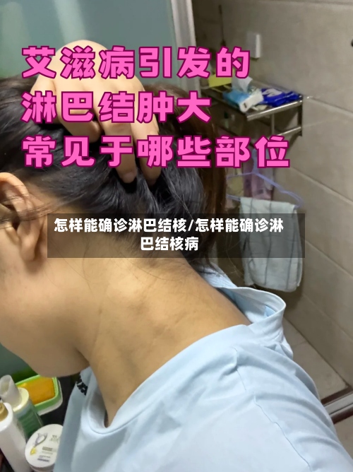 怎样能确诊淋巴结核/怎样能确诊淋巴结核病