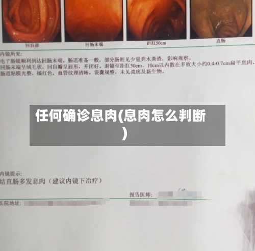 任何确诊息肉(息肉怎么判断)