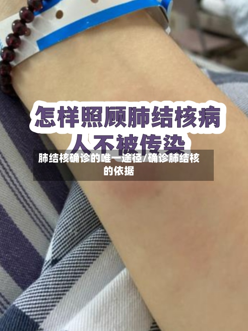 肺结核确诊的唯一途径/确诊肺结核的依据