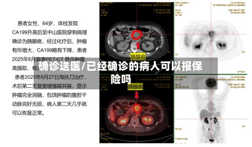 确诊送医/已经确诊的病人可以报保险吗