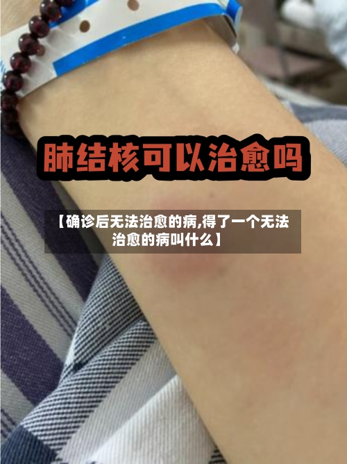 【确诊后无法治愈的病,得了一个无法治愈的病叫什么】
