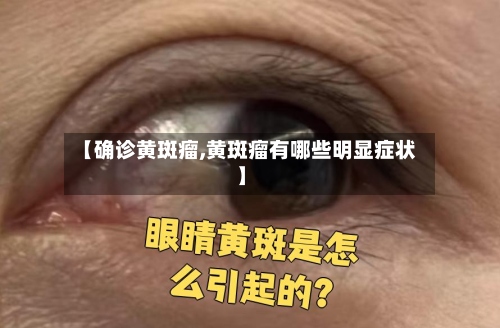 【确诊黄斑瘤,黄斑瘤有哪些明显症状】