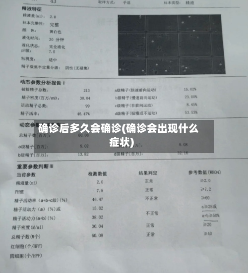 确诊后多久会确诊(确诊会出现什么症状)
